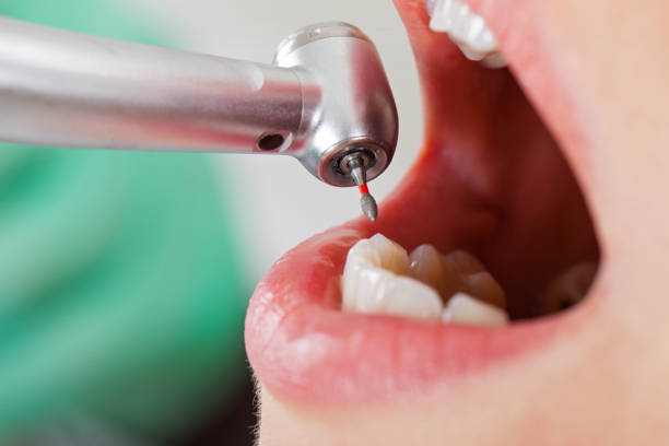 Best Weekend Emergency Dentist in Park Ridge, NJ